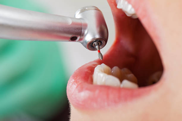 Best Emergency Treatment for Toothache in Cole Camp, MO